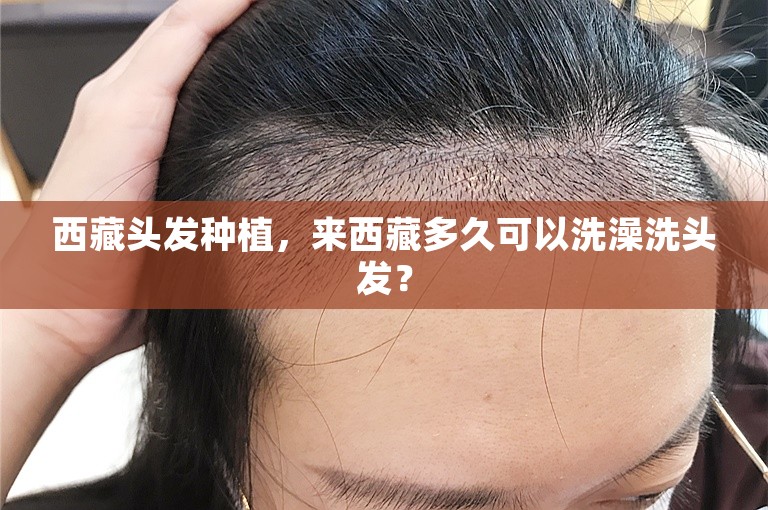 西藏头发种植，来西藏多久可以洗澡洗头发？