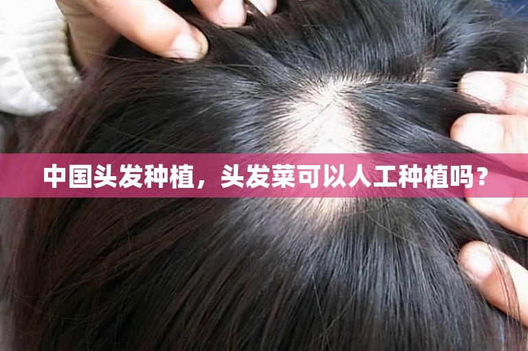 中国头发种植，头发菜可以人工种植吗？