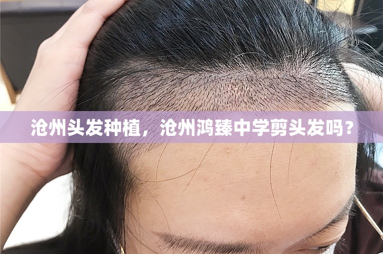 沧州头发种植，沧州鸿臻中学剪头发吗？