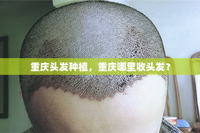 重庆头发种植，重庆哪里收头发？