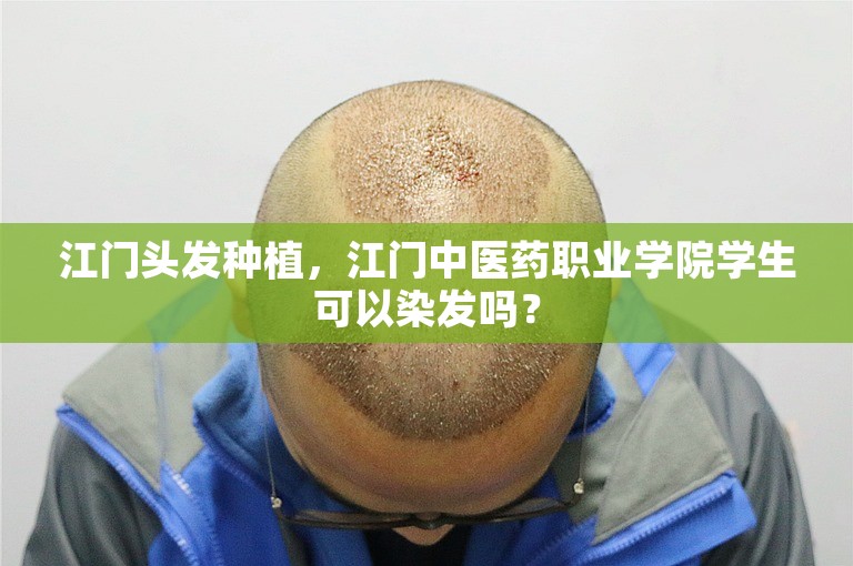 江门头发种植，江门中医药职业学院学生可以染发吗？