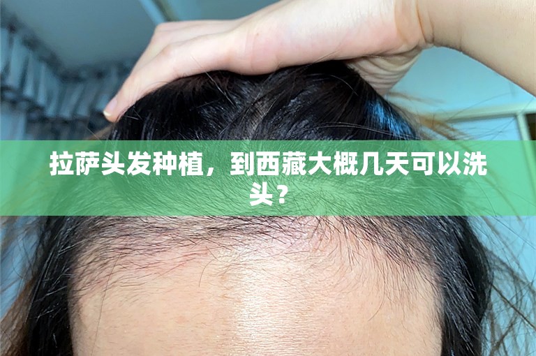 拉萨头发种植，到西藏大概几天可以洗头？